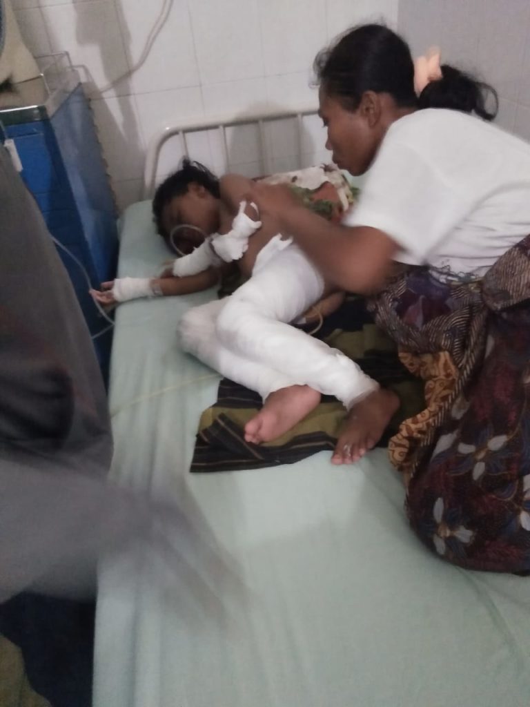 Dapur Rumah Terbakar Anak  Ikut Terbakar