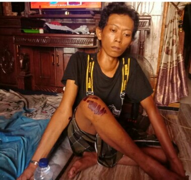 KEPEDULIAN KAPOLSEK SEMAMPIR TERHADAP MITRA KERJA SEORANG WARTAWAN YANG MENGALAMI KECELAKAAN
