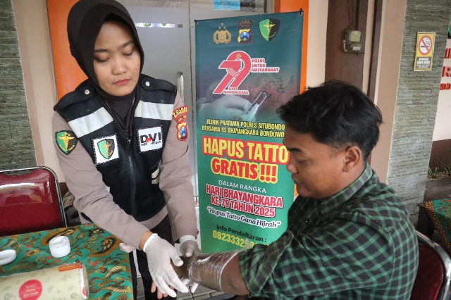 Polres Situbondo Memberikan Layanan Hapus Tato Gratis di HUT Bhayangkara Ke-79